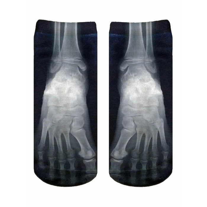 Pair of black ankle socks with a grayscale X-ray image of feet printed on them. The design shows the bones of the feet in detail. }}