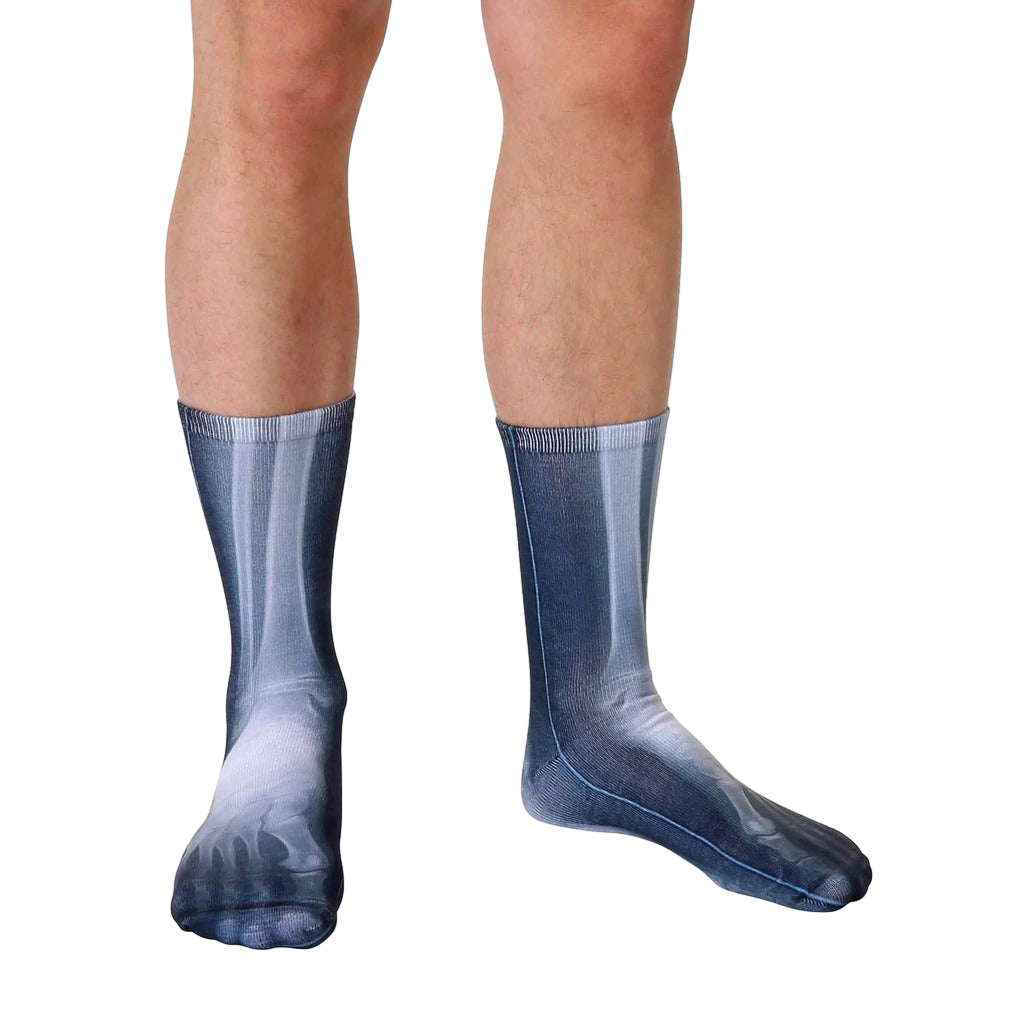 Lifestyle shot of X-Ray socks on a person's legs.  The socks' bone design is clearly visible. [lf]