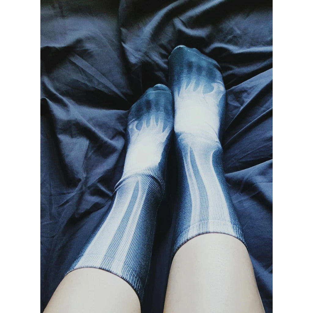 Close-up flat lay showcasing a pair of X-Ray socks. The image highlights the grayscale bone design detail and the sock's texture. [lf]