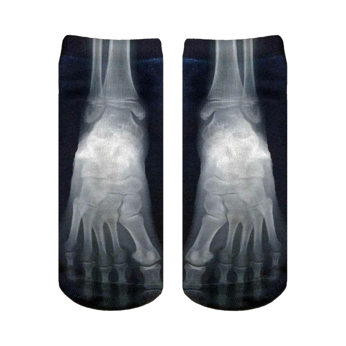 Pair of black ankle socks with a grayscale X-ray image of feet printed on them.  The design shows the bones of the feet in detail. }}